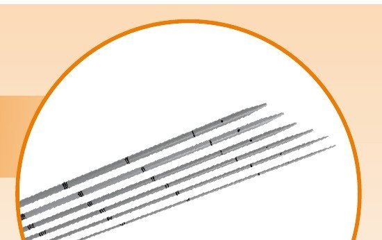 Set Dilatator Ureteral