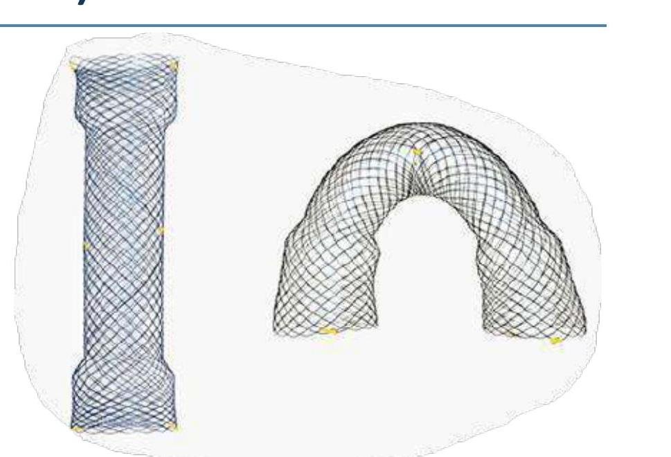 Stent Duodenal/Colonic/Rectal — Sistem OTW (pe fir de ghidaj)