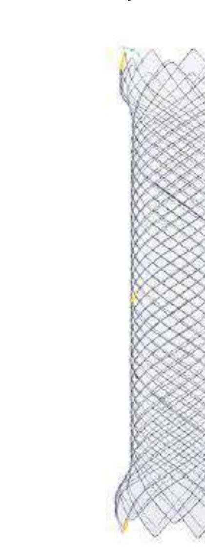 Stent Duodenal/Colonic — Sistem TTS (prin canalul endoscopului)