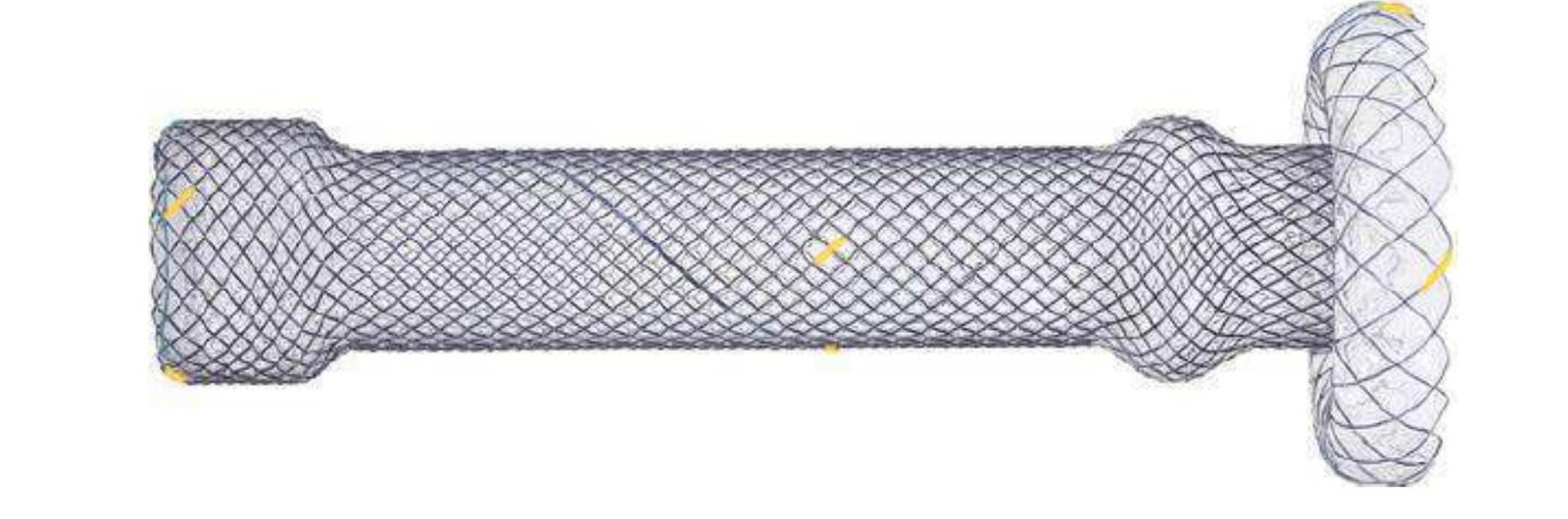 Stent Esofagian/Cardia cu Umbrelă (pentru Fistule)