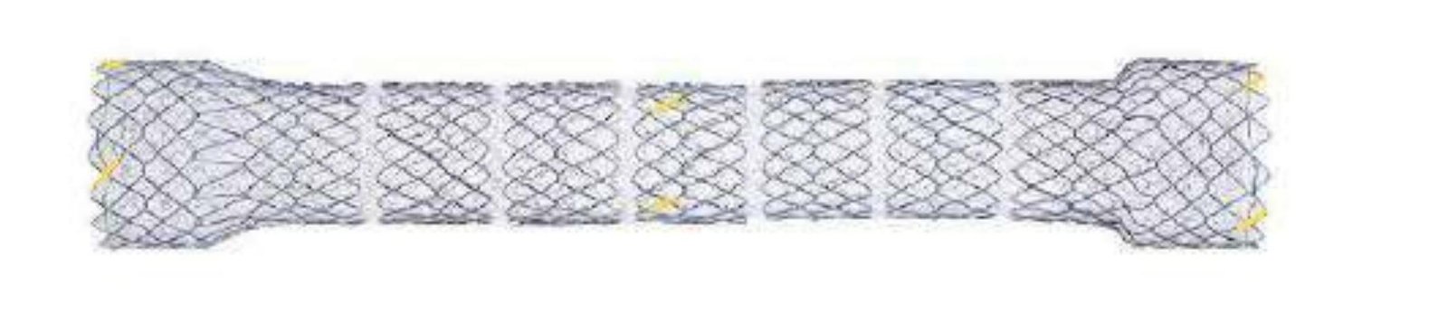 Stent Esofagian Segmentat