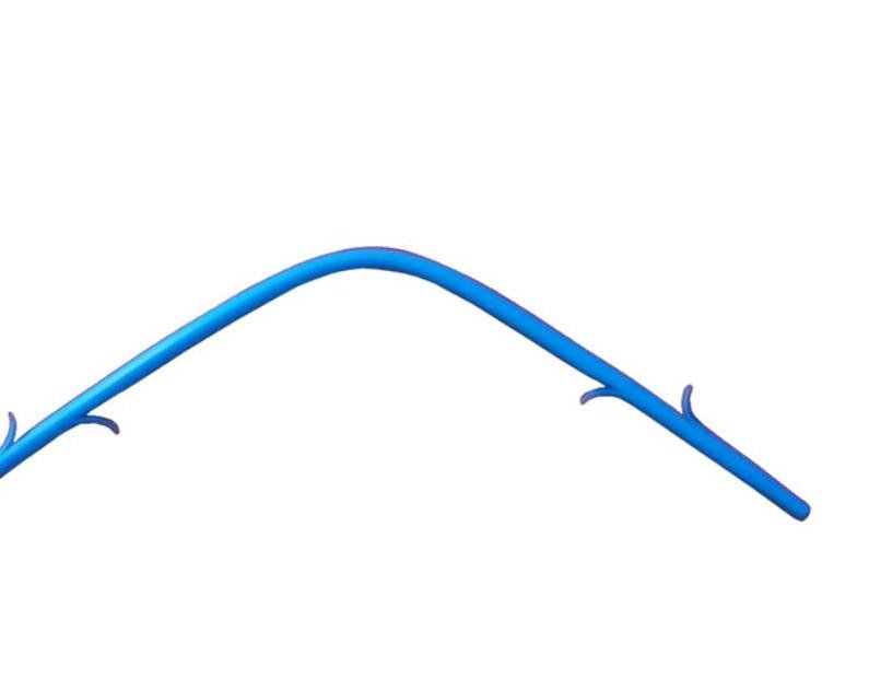 Stent Pancreatic — Curbat