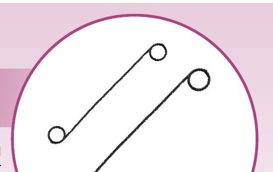 Stent Silicon Double J (Sili Soft Stent)