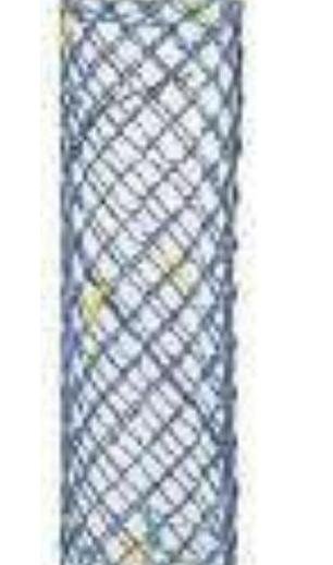 Stent Traheal