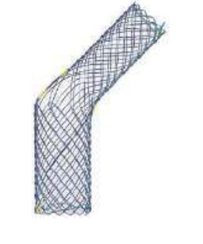 Stent Traheal cu Ocluzie pentru Fistulă — Formă J